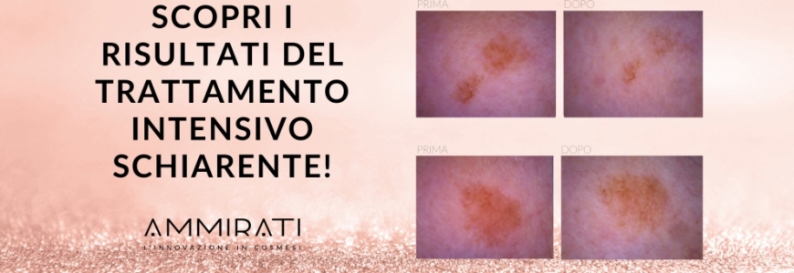 CHROMA DERMA E CHROMA SPOT....I RISULTATI!!!